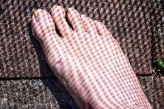 Foot Blight